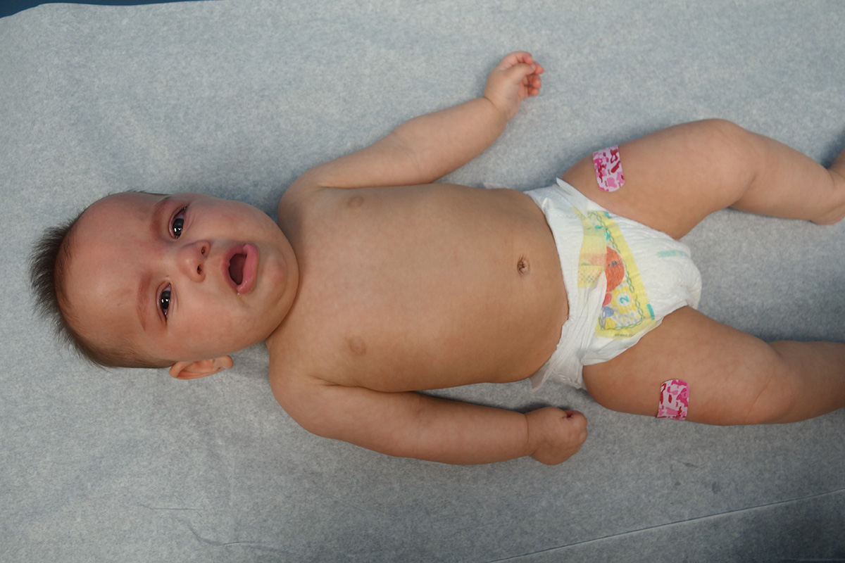 4 Months Checkup Eva Grace Eng